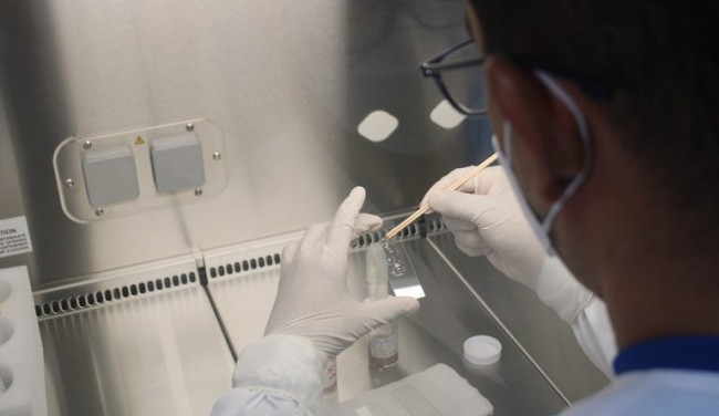 Autoridades de salud advierten sobre el aumento de casos de tuberculosis en Chiriquí