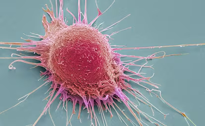 ¿Por qué el cáncer sigue existiendo? Una mirada evolutiva a una enfermedad antigua